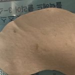 [극혐주의] 피지뽑음 개 <b>시원</b>