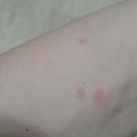 [댓글부탁해] <b>나화</b>상입었는데 이정도면