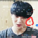 [EXO] 난 정말 멍청이고 <b>눈병</b>신임