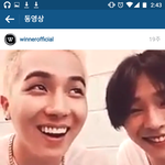 [송민호] 송민호 <b>치아</b>교정함?