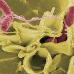 [건강] ** ‘식중독’<b>이여</b>, 영원히 안녕! **