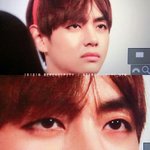 [방탄소년단] 태형이 쌍커풀 다시 사라짐