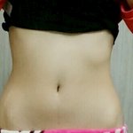 [댓글부탁해] 골반?<b>승마</b>살?판단해주세요.사진o