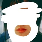 입주변 <b>색소</b>침착 어떻게 좀 도와주라..