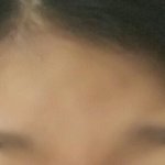 [드루와] <b>이마</b>좁은거 대결하자 나보다 <b>이마</b>좁은 사람나와봐ㅋㅋㅋㅋㅋ