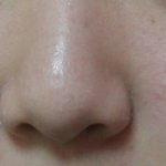 피부때문에 죽고싶어 관리법쫌