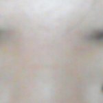 쌍수할건데