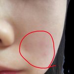 [댓글부탁해] 피부<b>지적</b>;