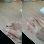 [도와주세요] 정형외과 의료과실 대처 어떻게 해야 하나요ㅠㅠ