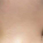 [댓글부탁해] 쌍수 잘 된 거 맞아???<b>짝짝이</b> 아닐까?ㅜㅜㅜ