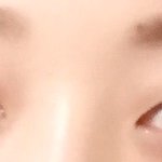 사진O)쌍수할까요? 봐주세요