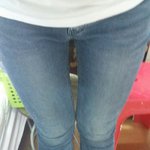 압구정의 지방<b>흡입</b>에 대하여~