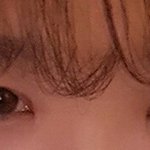 [댓글부탁해] 쌍수 절개 12일차 비루한 <b>비포</b>애프터