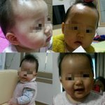 LX 대기업 불만제로 세탁기 아기아토피 저같은사람피해 안보게 꼭...