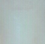 [쌍수] (추가) 쌍수6일차 오늘 <b>실밥</b>뽑으러가여!!!