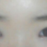 앞트임좀 봐주세요