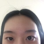[댓글부탁해] 쌍수 ㅠㅠ