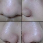 [봐주세요] 블랙<b>헤드</b>인가 모공인가(ㅜㅜㅜ진지해요,댓글좀ㅜㅜ.)