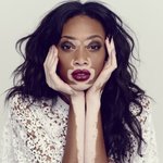 [백반증] 백반증 모델인 <b>위니</b> 할로우 아시나요?