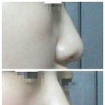 [드루와요] <b>콧대</b>조금울퉁(?)"댓글좀..