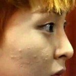 [방탄소년단] (<b>묵념</b>) 엑소 시우민의 여드름