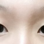 [댓글부탁해] <b>쌍수</b>해야될까