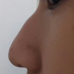 [댓글부탁해] 메<b>부리코</b> 많이심한거같아?