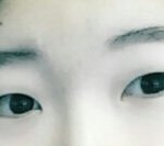 <b>이런눈</b> 쌍수나 앞트임 해야됌?