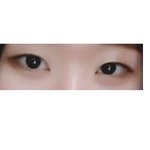 [쌍수] 2<b>주전</b>에 쌍수했어 후기!(약혐)