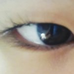 [댓글부탁해] 쌍커풀 전,후 평가좀