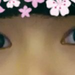 <b>들창코</b>