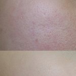 [댓글부탁해] 피부화장 보스 올린 글쓴이야 어떻게 하는지 쓸게!...