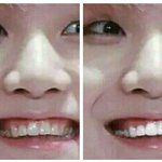 [방탄소년단] ㅅㄷ내가 윤기 치아<b>미백</b> 시켜줌ㅋㅋㅋ