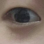 <b>눈밑주름</b> 어떻게없애? 제발들어와방ㅠㅠ