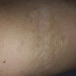 다들 몸이나 다리에 <b>흉터</b>같은거있어?