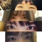 쌍커플 수술