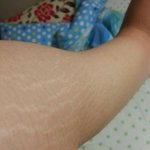 [댓글부탁해] 남자 어깨 튼살 <b>극혐</b>이야?