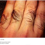 [유머판] 발모제 바를 때 <b>맨손</b>으로 하면 안되는 이유