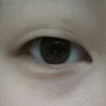 <b>사진o</b>)쌍수할까?ㅠㅠ