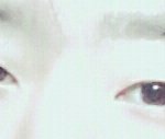 [댓글부탁해] 쌍커<b>풀</b>수술 할까?말까?
