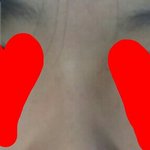 [댓글부탁해] 코<b>필러</b>맞고싶다 사진 ㅇㅋ
