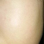 [드루와] (약혐)얼굴에 이거 왜이래?ㅜㅜ