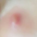 [댓글부탁해] 약혐?)ㅆㅂ나 코에 <b>왕여드름</b>났는데 이거 어찌해야하는것?