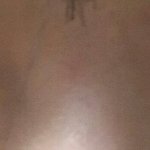 [조언부탁해] 앞트임 고민중인데 이거 몽고<b>주름</b>인가? 눈좀봐줘
