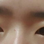 이런 <b>짝눈</b>은 어떡해야돼??
