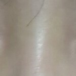 [조언부탁해] 나 쌍수하면 어떨 거 같애