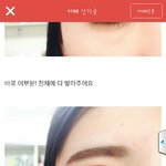 [댓글부탁해] 이분 뒷트임한거야?