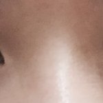 [조언부탁해] 쌍수할지<b>말지</b>조언좀!!