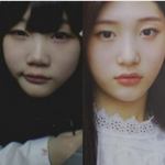 [EXO] 얘보니까 <b>성형</b>하고싶다