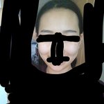 <b>앞광대</b>많이 부담스러워ㅜㅜ?